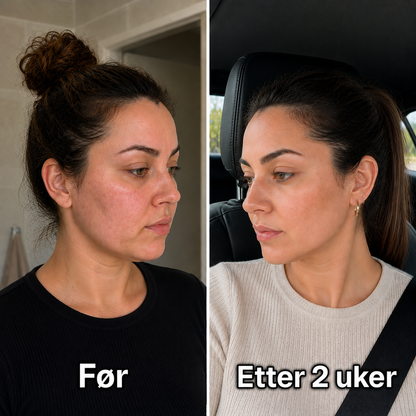 BeautyDrop™ - Demp hovenhet i ansiktet og kroppen, helt uten strev