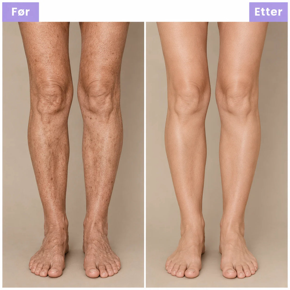 DermaGlow — Retinol Body Lotion