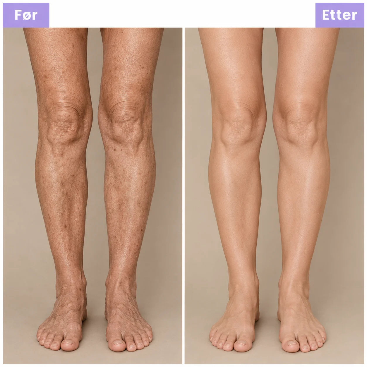 DermaGlow — Retinol Body Lotion