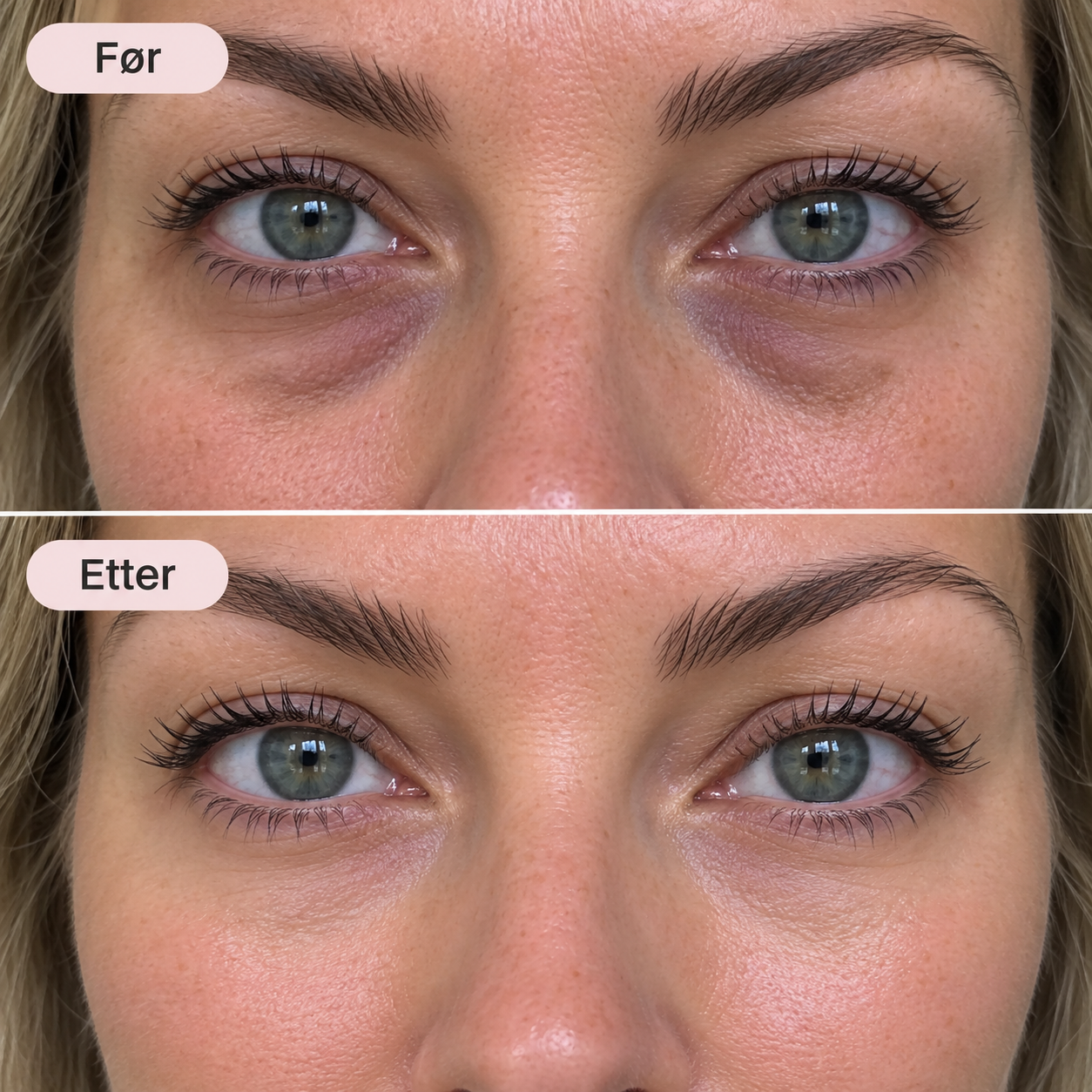 RetiGlow – Retinol serum