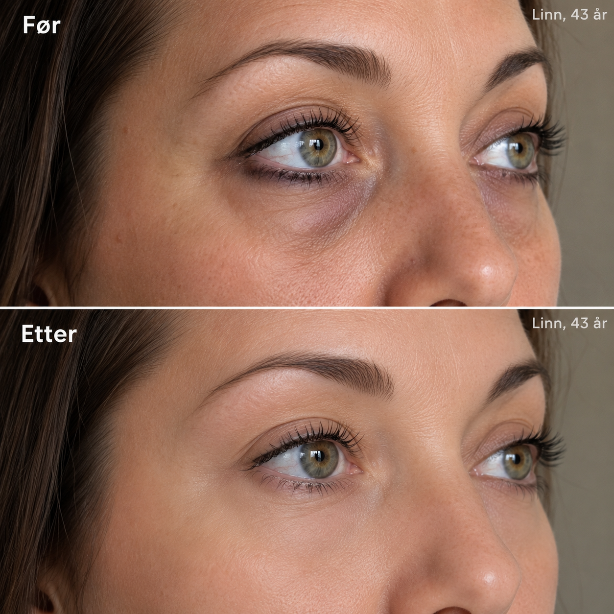 RetiGlow – Retinol serum
