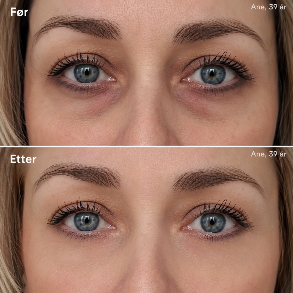 RetiGlow – Retinol serum