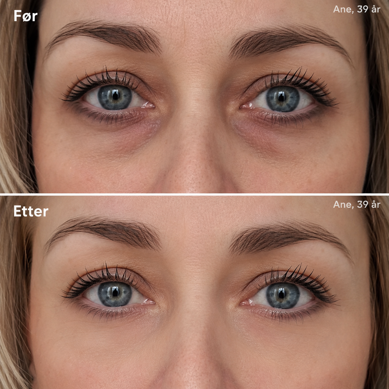 RetiGlow – Retinol serum